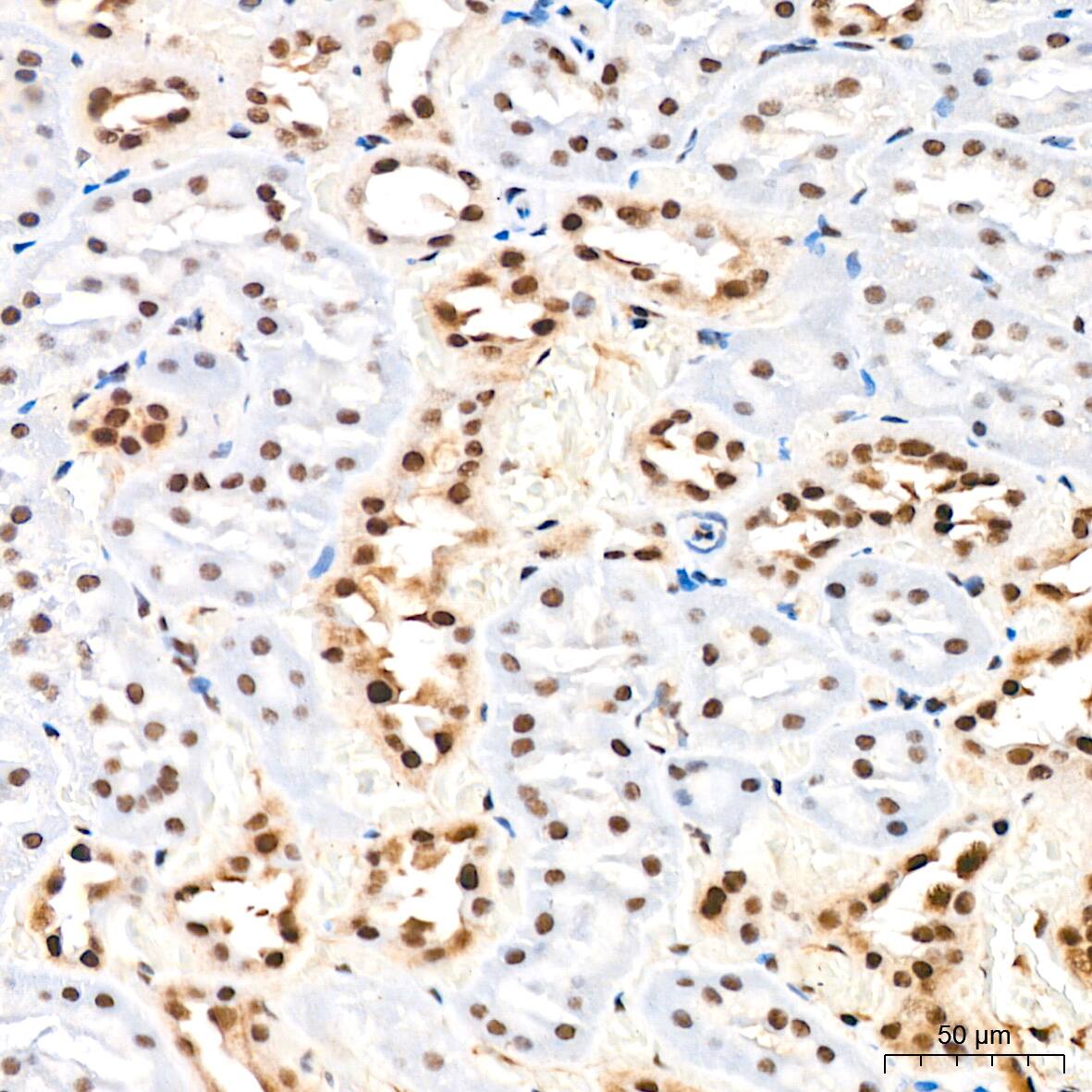 Immunohistochemistry: DDX17 Antibody (2U1P0) [NBP3-16607] - Immunohistochemistry analysis of DDX17 in paraffin-embedded rat kidney tissue using DDX17 Rabbit mAb  at a dilution of 1:200 (40x lens).High pressure antigen retrieval was performed with 0.01 M Tris-EDTA buffer (pH 9.0) prior to IHC staining.