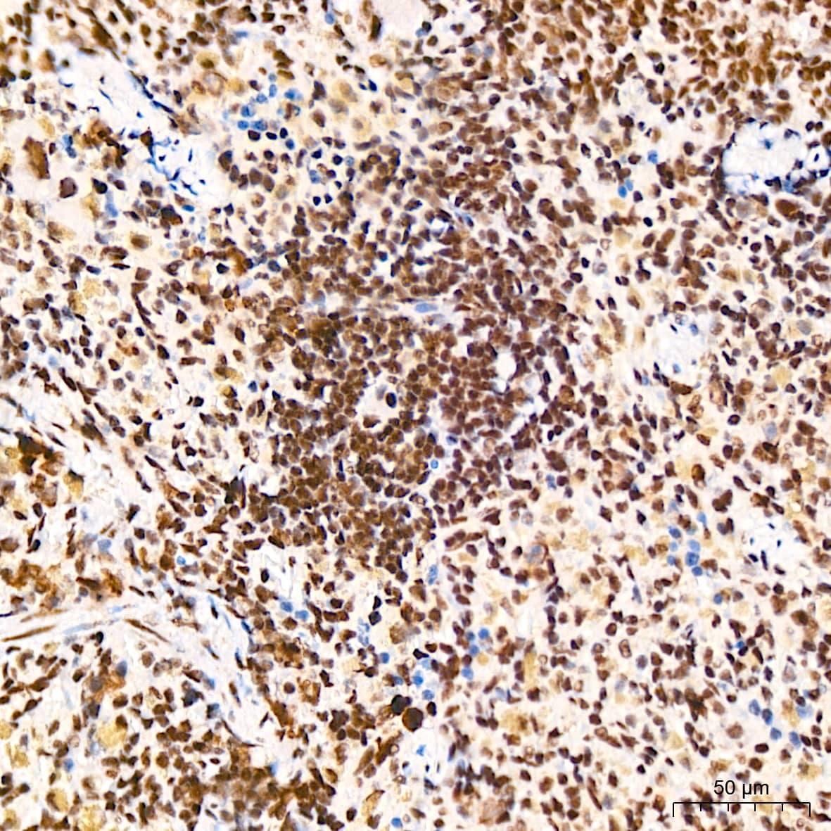 Immunohistochemistry DDX17 Antibody (2U1P0)