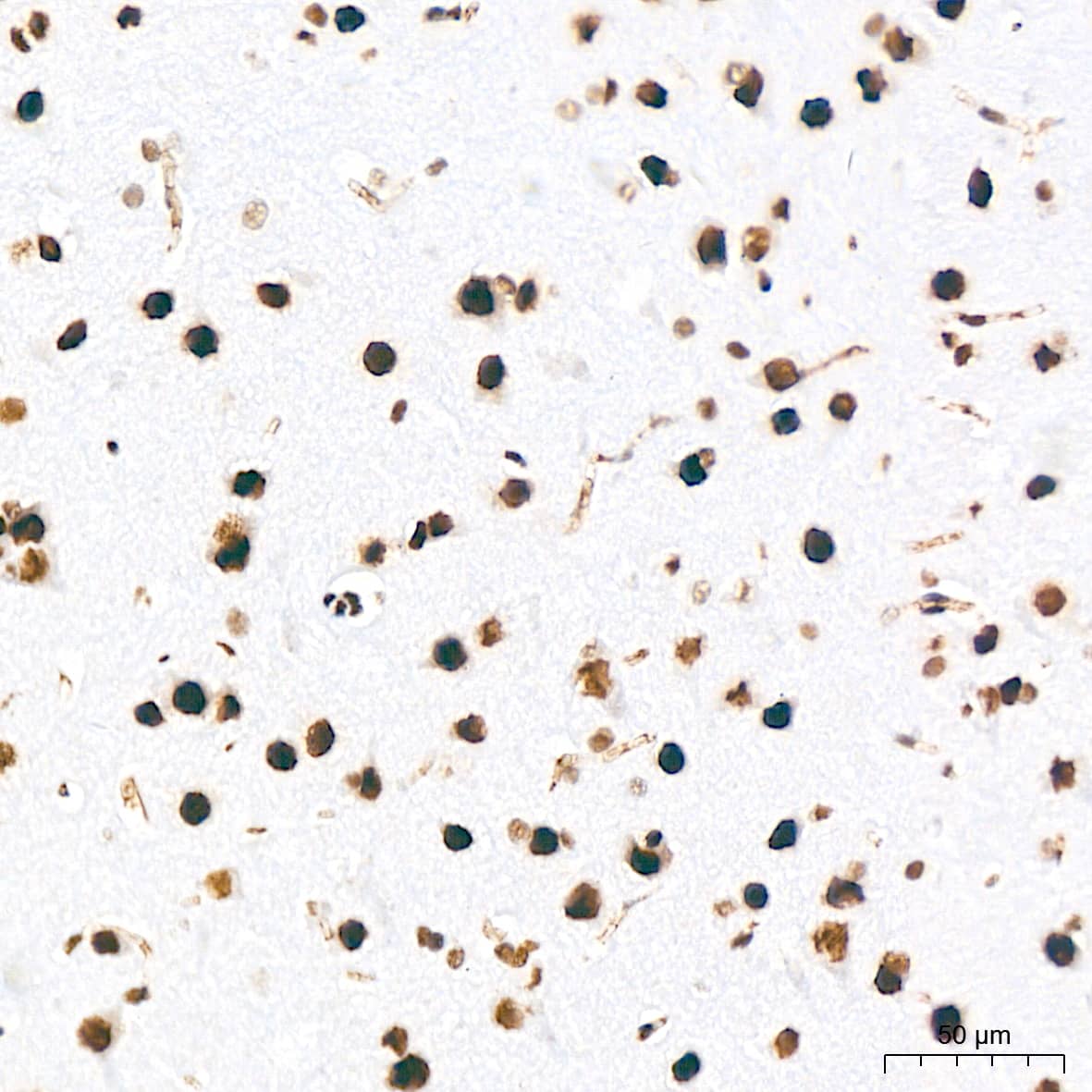 Immunohistochemistry: DDX17 Antibody (2U1P0) [NBP3-16607] - Immunohistochemistry analysis of DDX17 in paraffin-embedded mouse brain tissue using DDX17 Rabbit mAb  at a dilution of 1:200 (40x lens).High pressure antigen retrieval was performed with 0.01 M Tris-EDTA buffer (pH 9.0) prior to IHC staining.