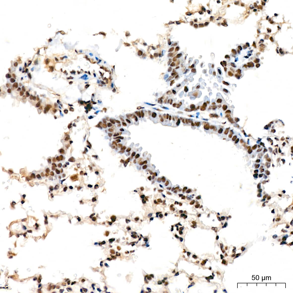 Immunohistochemistry: DDX17 Antibody (2U1P0) [NBP3-16607] - Immunohistochemistry analysis of DDX17 in paraffin-embedded mouse lung tissue using DDX17 Rabbit mAb  at a dilution of 1:200 (40x lens).High pressure antigen retrieval was performed with 0.01 M Tris-EDTA buffer (pH 9.0) prior to IHC staining.