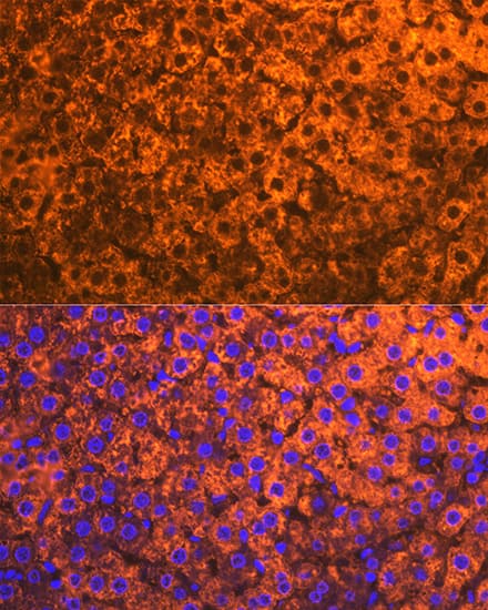 Immunocytochemistry/ Immunofluorescence: Cytochrome P450 2D6 Antibody (1X3F0) [NBP3-16610] - Immunofluorescence analysis of rat liver using Cytochrome P450 2D6 Rabbit mAb  at dilution of 1:100 (40x lens). Blue: DAPI for nuclear staining.