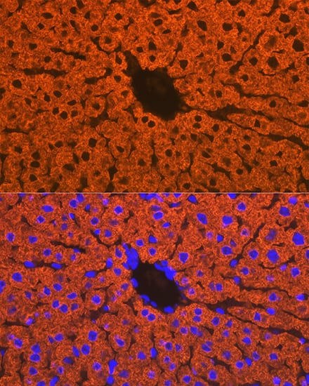 Immunocytochemistry/ Immunofluorescence: Cytochrome P450 2D6 Antibody (1X3F0) [NBP3-16610] - Immunofluorescence analysis of mouse liver using Cytochrome P450 2D6 Rabbit mAb  at dilution of 1:100 (40x lens). Blue: DAPI for nuclear staining.