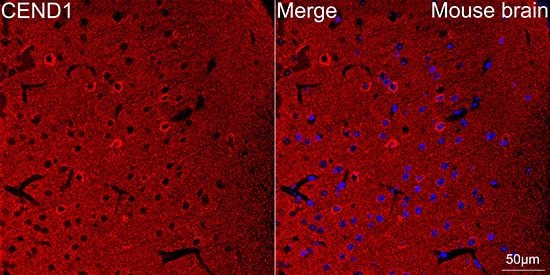 Immunocytochemistry/ Immunofluorescence: CEND1 Antibody (1D3Z1) [NBP3-16614] - Confocal imaging of paraffin-embedded Mouse brain tissue using CEND1 Rabbit mAb followed by a further incubation with Cy3 Goat Anti-Rabbit IgG (H+L) . DAPI was used for nuclear staining (Blue). Microwave antigen retrieval performed with 0.01M Citrate Buffer(pH 6.0) prior to IF staining. Objective: 40x.