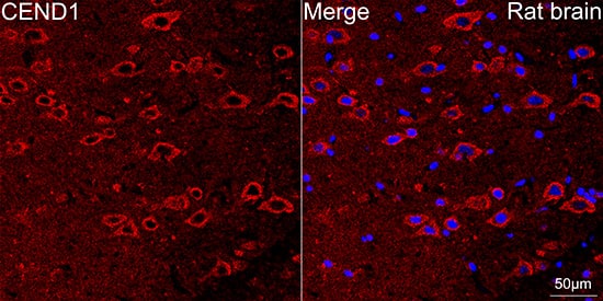 Immunocytochemistry/ Immunofluorescence: CEND1 Antibody (1D3Z1) [NBP3-16614] - Confocal imaging of paraffin-embedded Rat brain tissue using CEND1 Rabbit mAb followed by a further incubation with Cy3 Goat Anti-Rabbit IgG (H+L) . DAPI was used for nuclear staining (Blue). Microwave antigen retrieval performed with 0.01M Citrate Buffer(pH 6.0) prior to IF staining. Objective: 40x.