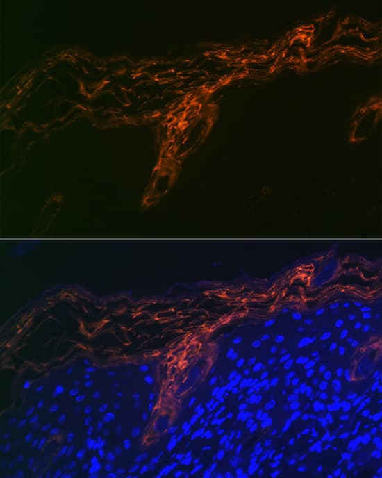 Immunocytochemistry/ Immunofluorescence: PERP Antibody (1O3L5) [NBP3-16617] - Immunofluorescence analysis of paraffin-embedded human skin using PERP Rabbit mAb at dilution of 1:100 (40x lens). Secondary antibody: Cy3-conjugated Goat anti-Rabbit IgG (H+L) at 1:500 dilution. Blue: DAPI for nuclear staining.