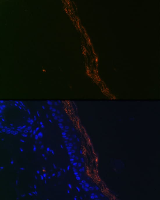 Immunocytochemistry/ Immunofluorescence: PERP Antibody (1O3L5) [NBP3-16617] - Immunofluorescence analysis of paraffin-embedded mouse skin using PERP Rabbit mAb at dilution of 1:100 (40x lens). Secondary antibody: Cy3-conjugated Goat anti-Rabbit IgG (H+L) at 1:500 dilution. Blue: DAPI for nuclear staining.