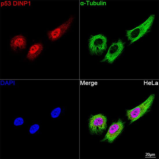 Immunocytochemistry/ Immunofluorescence: p53 DINP1 Antibody (9Y6Z7) [NBP3-16620] - Confocal imaging of HeLa cells using p53 DINP1 Rabbit mAb followed by a further incubation with Cy3 Goat Anti-Rabbit IgG (H+L) . The cells were counterstained with alpha-Tubulin Mouse mAb followed by incubation with ABflo(R) 488-conjugated Goat Anti-Mouse IgG (H+L) Ab (Green). DAPI was used for nuclear staining (Blue). Objective: 100x.
