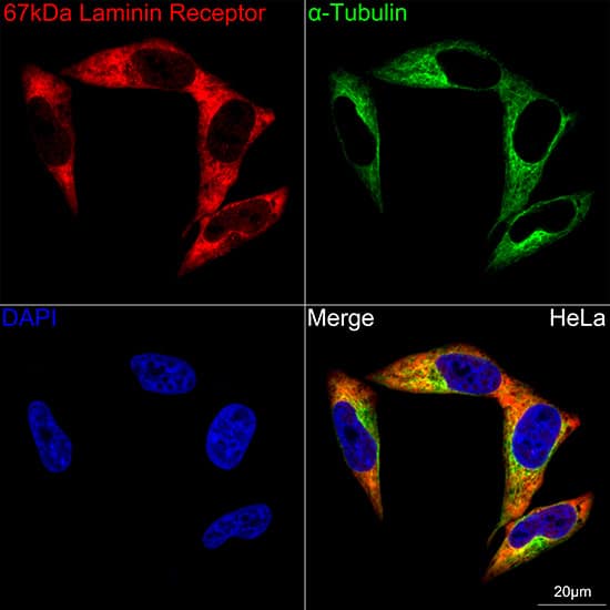 Immunocytochemistry/ Immunofluorescence: RPSA Antibody (2Q8Q6) [NBP3-16624] - Confocal imaging of HeLa cells using RPSA Rabbit mAb  followed by a further incubation with Cy3 Goat Anti-Rabbit IgG (H+L)  . The cells were counterstained with alpha-Tubulin Mouse mAb  followed by incubation with ABflo 488-conjugated Goat Anti-Mouse IgG (H+L) Ab  (Green). DAPI was used for nuclear staining (Blue). Objective: 100x.