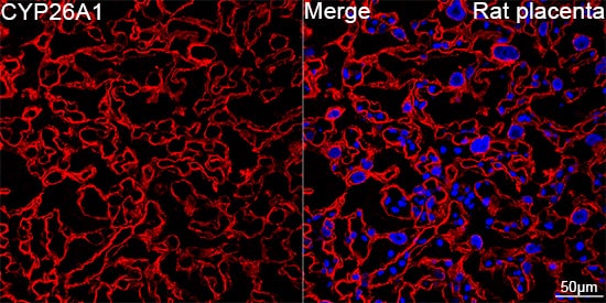 Immunocytochemistry/ Immunofluorescence CYP26A1 Antibody (1E1D2)