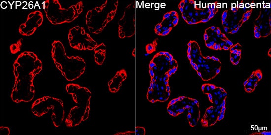 Immunocytochemistry/ Immunofluorescence: CYP26A1 Antibody (1E1D2) [NBP3-16627] - Confocal imaging of paraffin-embedded Human placenta using CYP26A1 Rabbit mAb followed by a further incubation with Cy3 Goat Anti-Rabbit IgG (H+L) . DAPI was used for nuclear staining (Blue). Objective: 40x. Perform high pressure antigen retrieval with 0.01 M citrate buffer (pH 6.0) prior to IF staining.