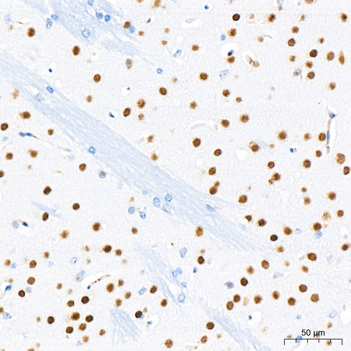 Immunohistochemistry: CHD3 Antibody (8Z6L6) [NBP3-16632] - Immunohistochemistry analysis of CHD3 in paraffin-embedded mouse brain tissue using CHD3 Rabbit mAb at a dilution of 1:200 (40x lens).High pressure antigen retrieval was performed with 0.01 M citrate buffer (pH 6.0) prior to IHC staining.