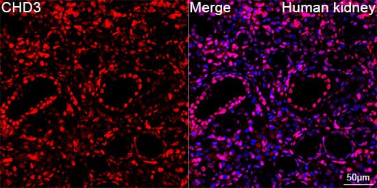 Immunocytochemistry/ Immunofluorescence: CHD3 Antibody (8Z6L6) [NBP3-16632] - Confocal imaging of paraffin-embedded Human kidney using CHD3 Rabbit mAb  followed by a further incubation with Cy3 Goat Anti-Rabbit IgG (H+L).DAPI was used for nuclear staining (Blue). Objective: 40x. Perform high pressure antigen retrieval with 0.01 M citRate buffer (pH 6.0) prior to IF staining.