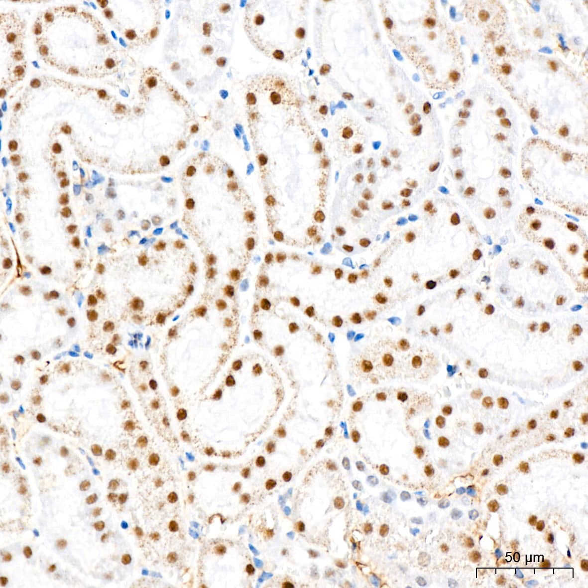 Immunohistochemistry: CHD3 Antibody (8Z6L6) [NBP3-16632] - Immunohistochemistry analysis of CHD3 in paraffin-embedded mouse kidney tissue using CHD3 Rabbit mAb at a dilution of 1:200 (40x lens).High pressure antigen retrieval was performed with 0.01 M citrate buffer (pH 6.0) prior to IHC staining.