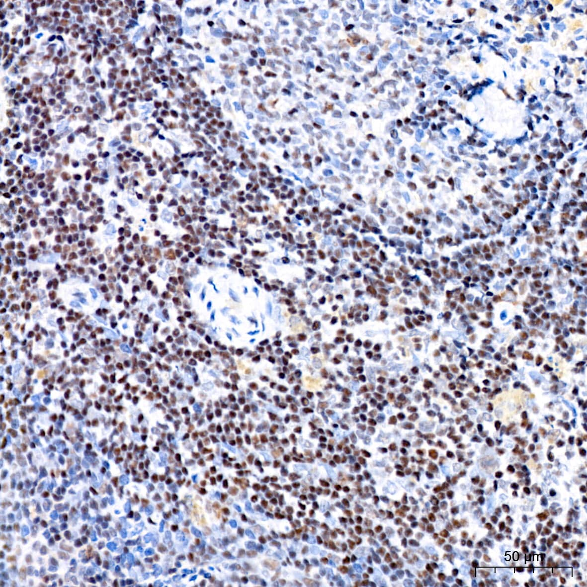 Immunohistochemistry: CHD3 Antibody (8Z6L6) [NBP3-16632] - Immunohistochemistry analysis of CHD3 in paraffin-embedded rat spleen tissue using CHD3 Rabbit mAb at a dilution of 1:200 (40x lens).High pressure antigen retrieval was performed with 0.01 M citrate buffer (pH 6.0) prior to IHC staining.