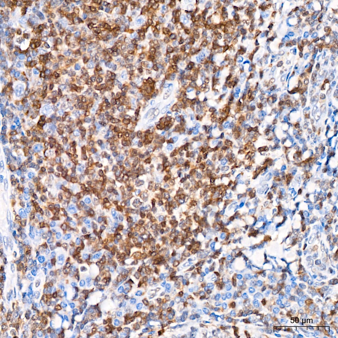 Immunohistochemistry: CHD3 Antibody (8Z6L6) [NBP3-16632] - Immunohistochemistry analysis of CHD3 in paraffin-embedded human tonsil tissue using CHD3 Rabbit mAb at a dilution of 1:200 (40x lens).High pressure antigen retrieval was performed with 0.01 M citrate buffer (pH 6.0) prior to IHC staining.