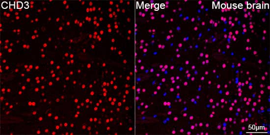 Immunocytochemistry/ Immunofluorescence: CHD3 Antibody (8Z6L6) [NBP3-16632] - Confocal imaging of paraffin-embedded Mouse brain using CHD3 Rabbit mAb  followed by a further incubation with Cy3 Goat Anti-Rabbit IgG (H+L).DAPI was used for nuclear staining (Blue). Objective: 40x. Perform microwave antigen retrieval with 0.01 M citRate buffer (pH 6.0) prior to IF staining.