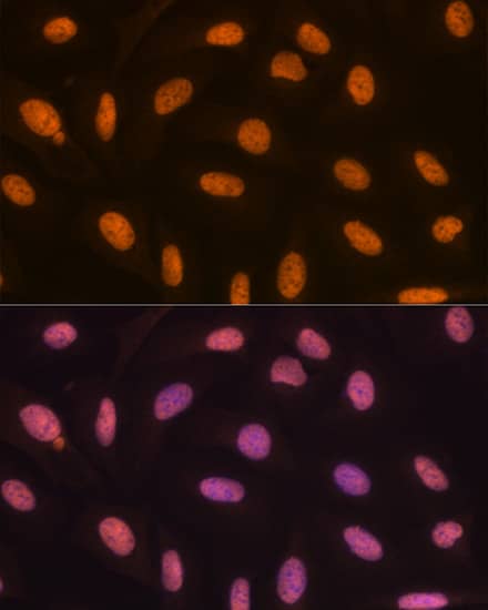 Immunocytochemistry/ Immunofluorescence: JMJD2B Antibody (8I0I1) [NBP3-16639] - Immunofluorescence analysis of U-2 OS cells using JMJD2B Rabbit mAb at dilution of 1:100 (40x lens). Secondary antibody: Cy3-conjugated Goat anti-Rabbit IgG (H+L) at 1:500 dilution. Blue: DAPI for nuclear staining.