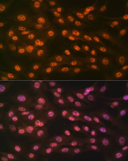 Immunocytochemistry/ Immunofluorescence: JMJD2B Antibody (8I0I1) [NBP3-16639] - Immunofluorescence analysis of C6 cells using JMJD2B Rabbit mAb at dilution of 1:100 (40x lens). Secondary antibody: Cy3-conjugated Goat anti-Rabbit IgG (H+L) at 1:500 dilution. Blue: DAPI for nuclear staining.