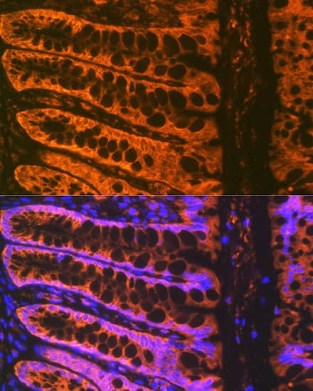 Immunocytochemistry/ Immunofluorescence: ADAM15 Antibody (4T4X10) [NBP3-16642] - Immunofluorescence analysis of paraffin-embedded rat rectum using ADAM15 Rabbit mAb at dilution of 1:100 (40x lens). Secondary antibody: Cy3-conjugated Goat anti-Rabbit IgG (H+L) at 1:500 dilution. Blue: DAPI for nuclear staining.