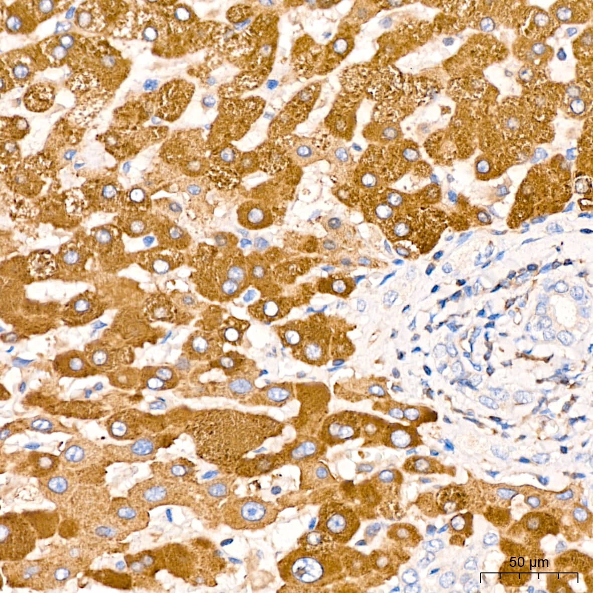 Immunohistochemistry: ADAM15 Antibody (4T4X10) [NBP3-16642] - Immunohistochemistry analysis of paraffin-embedded Human liver tissue using ADAM15 Rabbit mAb at a dilution of 1:200 (40x lens). High pressure antigen retrieval performed with 0.01M Citrate Bufferr (pH 6.0) prior to IHC staining.