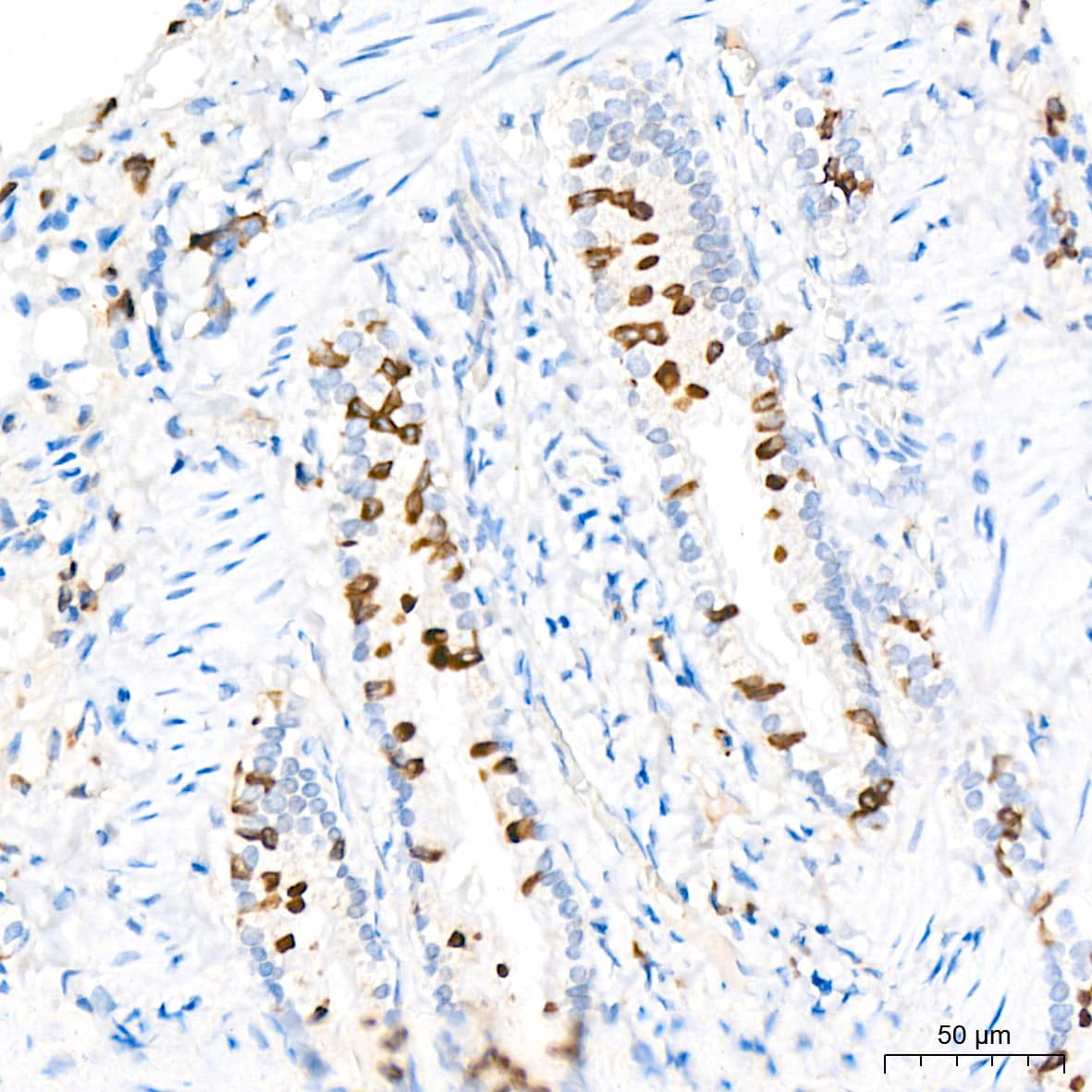 Immunohistochemistry: ADAM15 Antibody (4T4X10) [NBP3-16642] - Immunohistochemistry analysis of paraffin-embedded Rat lung tissue using ADAM15 Rabbit mAb at a dilution of 1:200 (40x lens). High pressure antigen retrieval performed with 0.01M Citrate Bufferr (pH 6.0) prior to IHC staining.