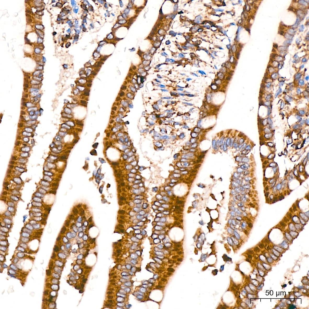 Immunohistochemistry: ADAM15 Antibody (4T4X10) [NBP3-16642] - Immunohistochemistry analysis of paraffin-embedded Human small intestine tissue using ADAM15 Rabbit mAb at a dilution of 1:200 (40x lens). High pressure antigen retrieval performed with 0.01M Citrate Bufferr (pH 6.0) prior to IHC staining.