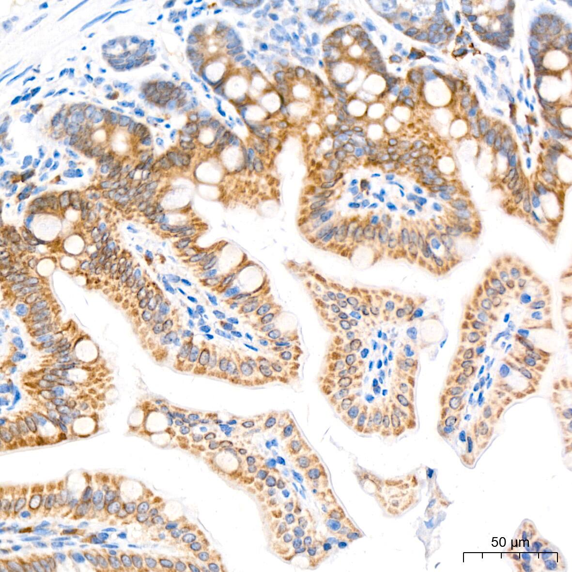 Immunohistochemistry: ADAM15 Antibody (4T4X10) [NBP3-16642] - Immunohistochemistry analysis of paraffin-embedded Mouse intestin tissue using ADAM15 Rabbit mAb at a dilution of 1:200 (40x lens). High pressure antigen retrieval performed with 0.01M Citrate Bufferr (pH 6.0) prior to IHC staining.