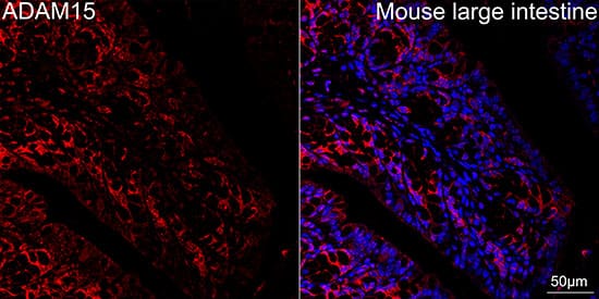 Immunocytochemistry/ Immunofluorescence: ADAM15 Antibody (4T4X10) [NBP3-16642] - Confocal imaging of paraffin-embedded mouse large intestine using ADAM15 Rabbit mAb followed by a further incubation with Cy3 Goat Anti-Rabbit IgG (H+L).DAPI was used for nuclear staining (Blue). Objective: 40x.Perform high pressure antigen retrieval with 0.01M citrate buffer (pH 6.0) prior to IF staining.