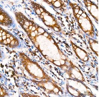 Immunohistochemistry-Paraffin: alpha Tubulin 4a Antibody (1K6U1) [NBP3-16646] - Human colon using  alpha -Tubulin Rabbit mAb at dilution of 1:200 (40x lens). High pressure antigen retrieval performed with 0.01M Citrate Bufferr (pH 6.0) prior to IHC staining.