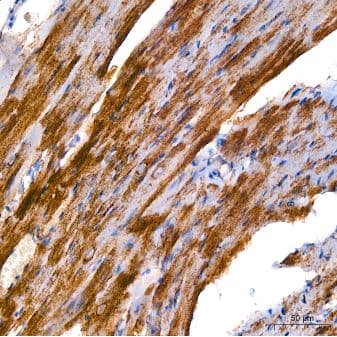 Immunohistochemistry-Paraffin: alpha Tubulin 4a Antibody (1K6U1) [NBP3-16646] - Mouse heart using  alpha -Tubulin Rabbit mAb at dilution of 1:200 (40x lens). High pressure antigen retrieval performed with 0.01M Citrate Bufferr (pH 6.0) prior to IHC staining.