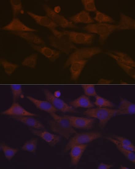 Immunocytochemistry/ Immunofluorescence: PKC delta Antibody (7I5U6) [NBP3-16660] - Immunofluorescence analysis of NIH-3T3 cells using PKC delta Rabbit mAb  at dilution of 1:100 (40x lens). Secondary antibody: Cy3 Goat Anti-Rabbit IgG (H+L)  at 1:500 dilution. Blue: DAPI for nuclear staining.