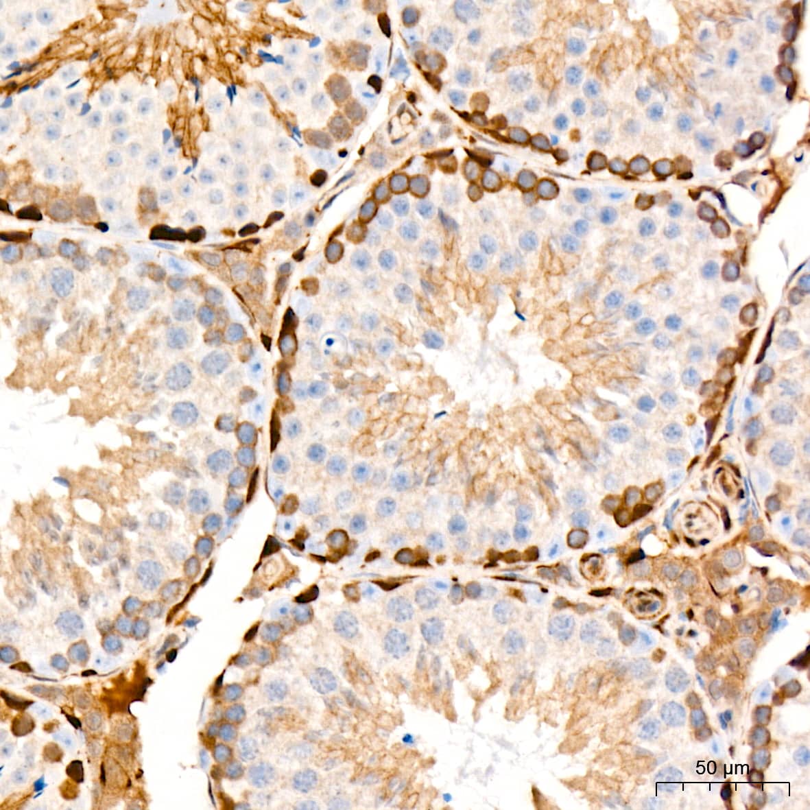 Immunohistochemistry: PKC delta Antibody (7I5U6) [NBP3-16660] - Immunohistochemistry analysis of PKC delta in paraffin-embedded mouse testis tissue using PKC delta Rabbit mAb  at a dilution of 1:200 (40x lens). High pressure antigen retrieval was performed with 0.01 M citrate buffer (pH 6.0) prior to IHC staining.