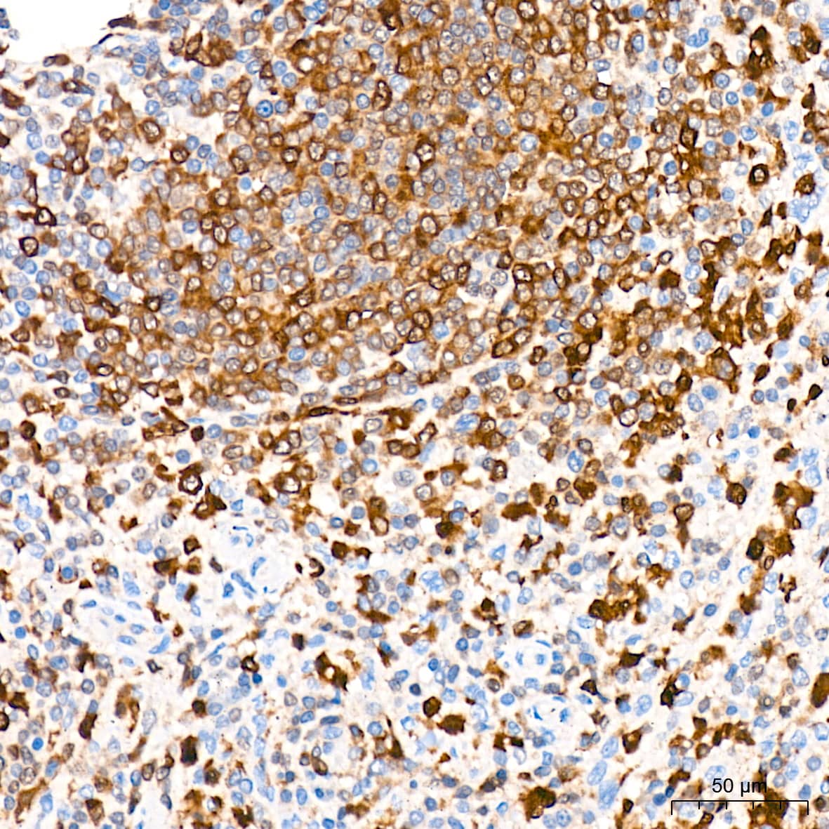 Immunohistochemistry: PKC delta Antibody (7I5U6) [NBP3-16660] - Immunohistochemistry analysis of PKC delta in paraffin-embedded human spleen tissue using PKC delta Rabbit mAb  at a dilution of 1:200 (40x lens). High pressure antigen retrieval was performed with 0.01 M citrate buffer (pH 6.0) prior to IHC staining.