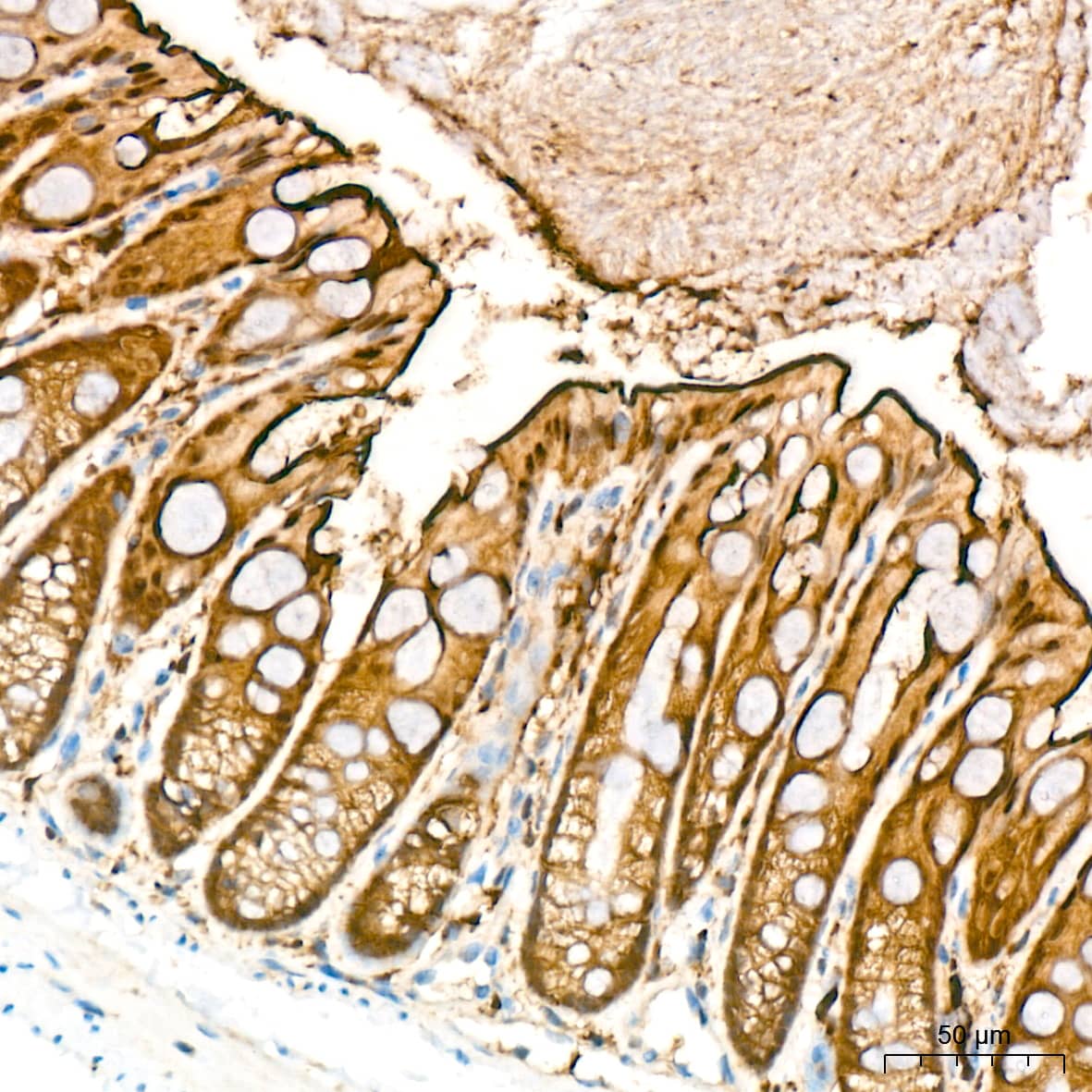 Immunohistochemistry: PKC delta Antibody (7I5U6) [NBP3-16660] - Immunohistochemistry analysis of PKC delta in paraffin-embedded mouse colon tissue using PKC delta Rabbit mAb  at a dilution of 1:200 (40x lens). High pressure antigen retrieval was performed with 0.01 M citrate buffer (pH 6.0) prior to IHC staining.