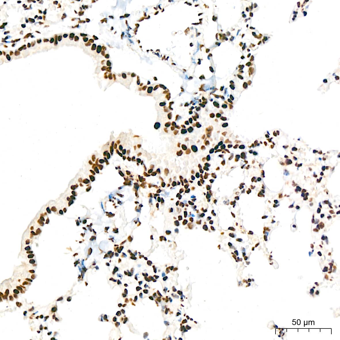 Immunohistochemistry: ILF3 Antibody (0S2N7) [NBP3-16664] - Immunohistochemistry analysis of ILF3 in paraffin-embedded mouse lung tissue using ILF3 Rabbit mAb  at a dilution of 1:200 (40x lens). High pressure antigen retrieval was performed with 0.01 M citrate buffer (pH 6.0) prior to IHC staining.