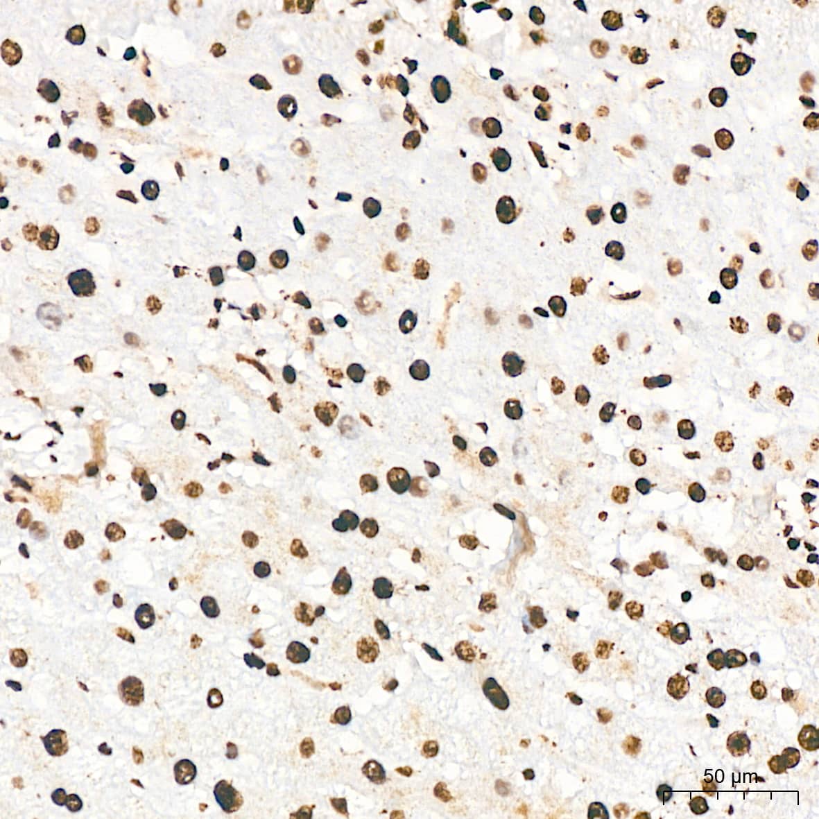 Immunohistochemistry: ILF3 Antibody (0S2N7) [NBP3-16664] - Immunohistochemistry analysis of ILF3 in paraffin-embedded human liver tissue using ILF3 Rabbit mAb  at a dilution of 1:200 (40x lens). High pressure antigen retrieval was performed with 0.01 M citrate buffer (pH 6.0) prior to IHC staining.