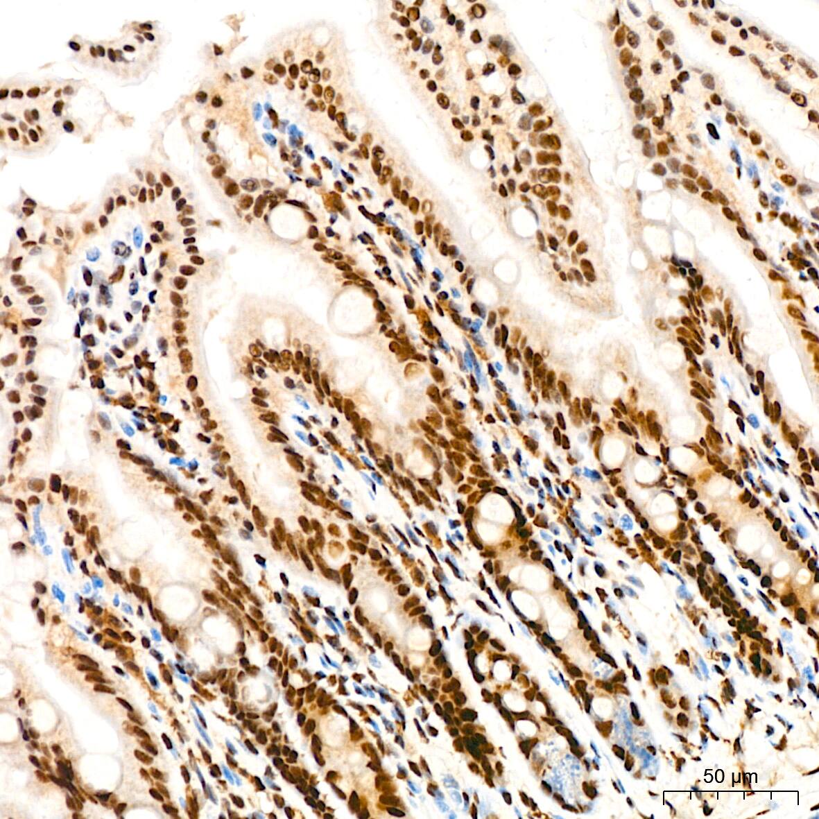 Immunohistochemistry: ILF3 Antibody (0S2N7) [NBP3-16664] - Immunohistochemistry analysis of ILF3 in paraffin-embedded mouse colon tissue using ILF3 Rabbit mAb  at a dilution of 1:200 (40x lens). High pressure antigen retrieval was performed with 0.01 M citrate buffer (pH 6.0) prior to IHC staining.