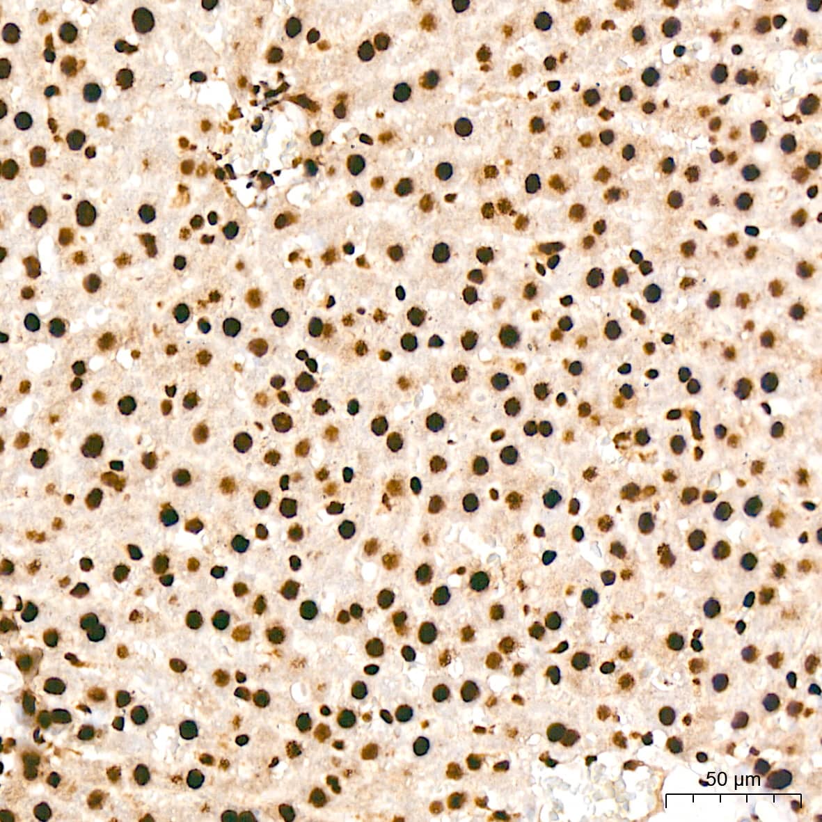 Immunohistochemistry: ILF3 Antibody (0S2N7) [NBP3-16664] - Immunohistochemistry analysis of ILF3 in paraffin-embedded rat liver tissue using ILF3 Rabbit mAb  at a dilution of 1:200 (40x lens). High pressure antigen retrieval was performed with 0.01 M citrate buffer (pH 6.0) prior to IHC staining.