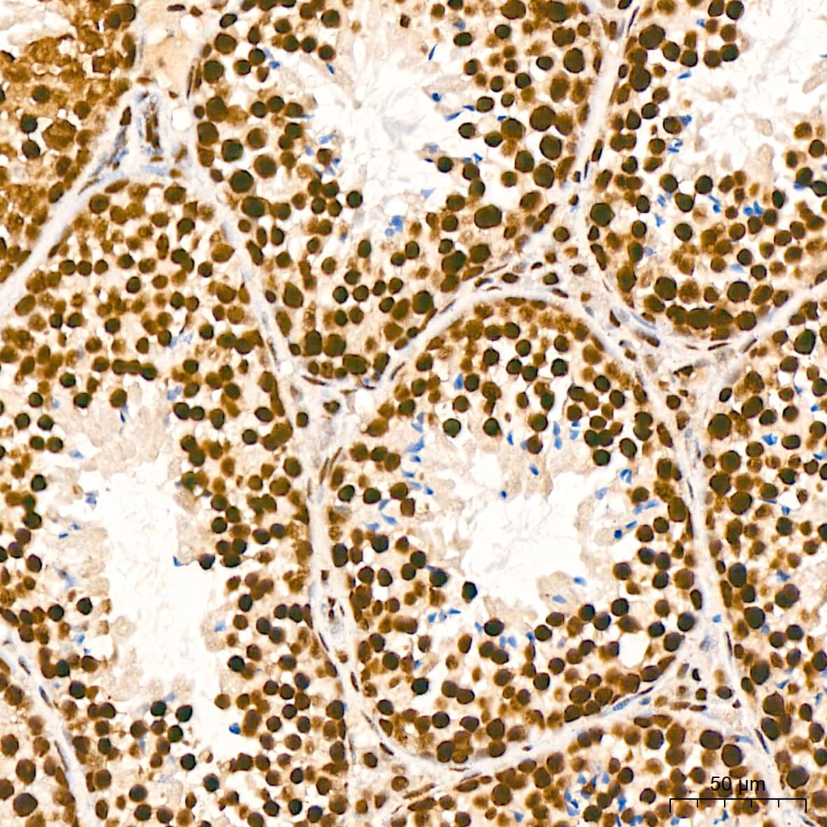 Immunohistochemistry: ILF3 Antibody (0S2N7) [NBP3-16664] - Immunohistochemistry analysis of ILF3 in paraffin-embedded mouse testis tissue using ILF3 Rabbit mAb  at a dilution of 1:200 (40x lens). High pressure antigen retrieval was performed with 0.01 M citrate buffer (pH 6.0) prior to IHC staining.