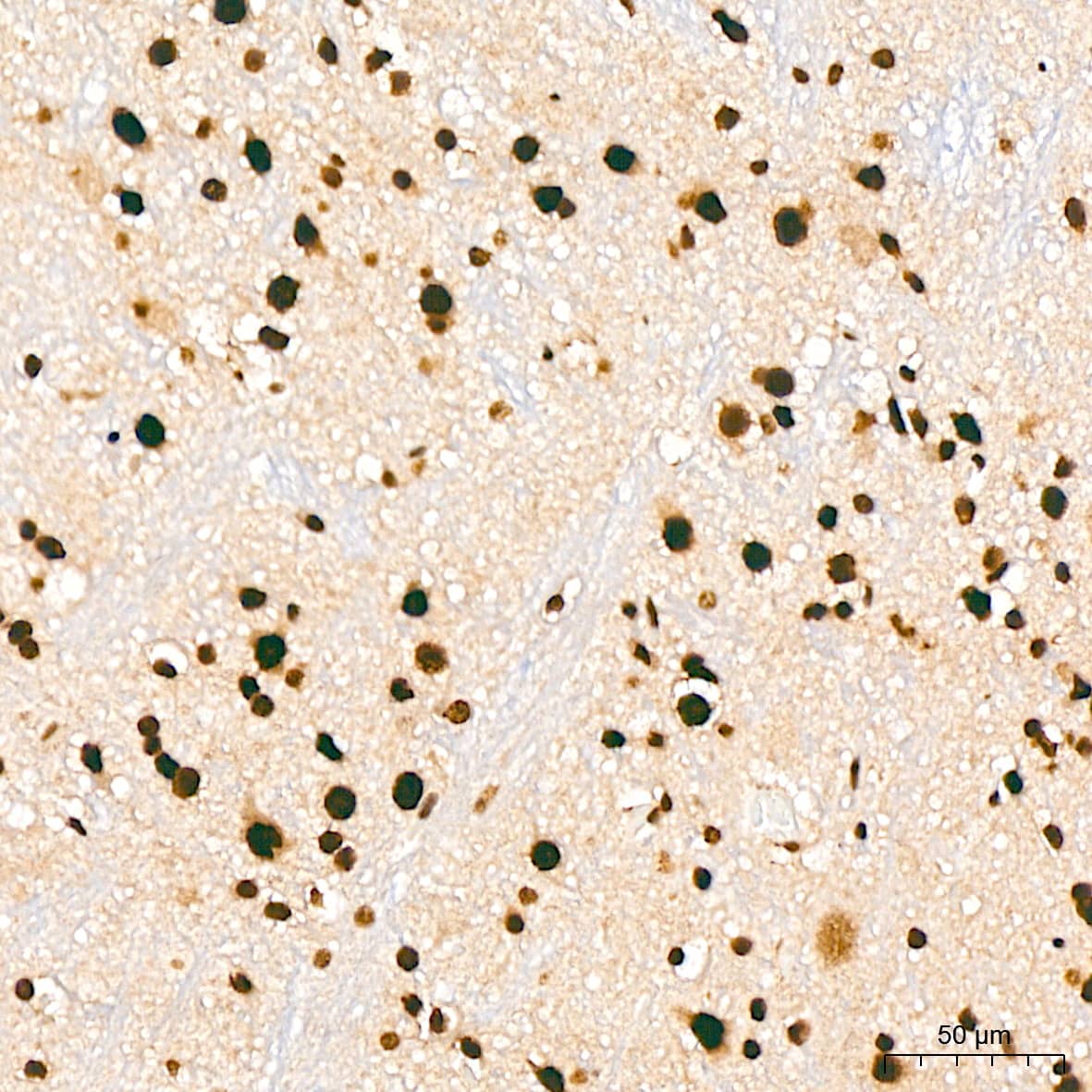 Immunohistochemistry: ILF3 Antibody (0S2N7) [NBP3-16664] - Immunohistochemistry analysis of ILF3 in paraffin-embedded mouse brain tissue using ILF3 Rabbit mAb  at a dilution of 1:200 (40x lens). High pressure antigen retrieval was performed with 0.01 M citrate buffer (pH 6.0) prior to IHC staining.