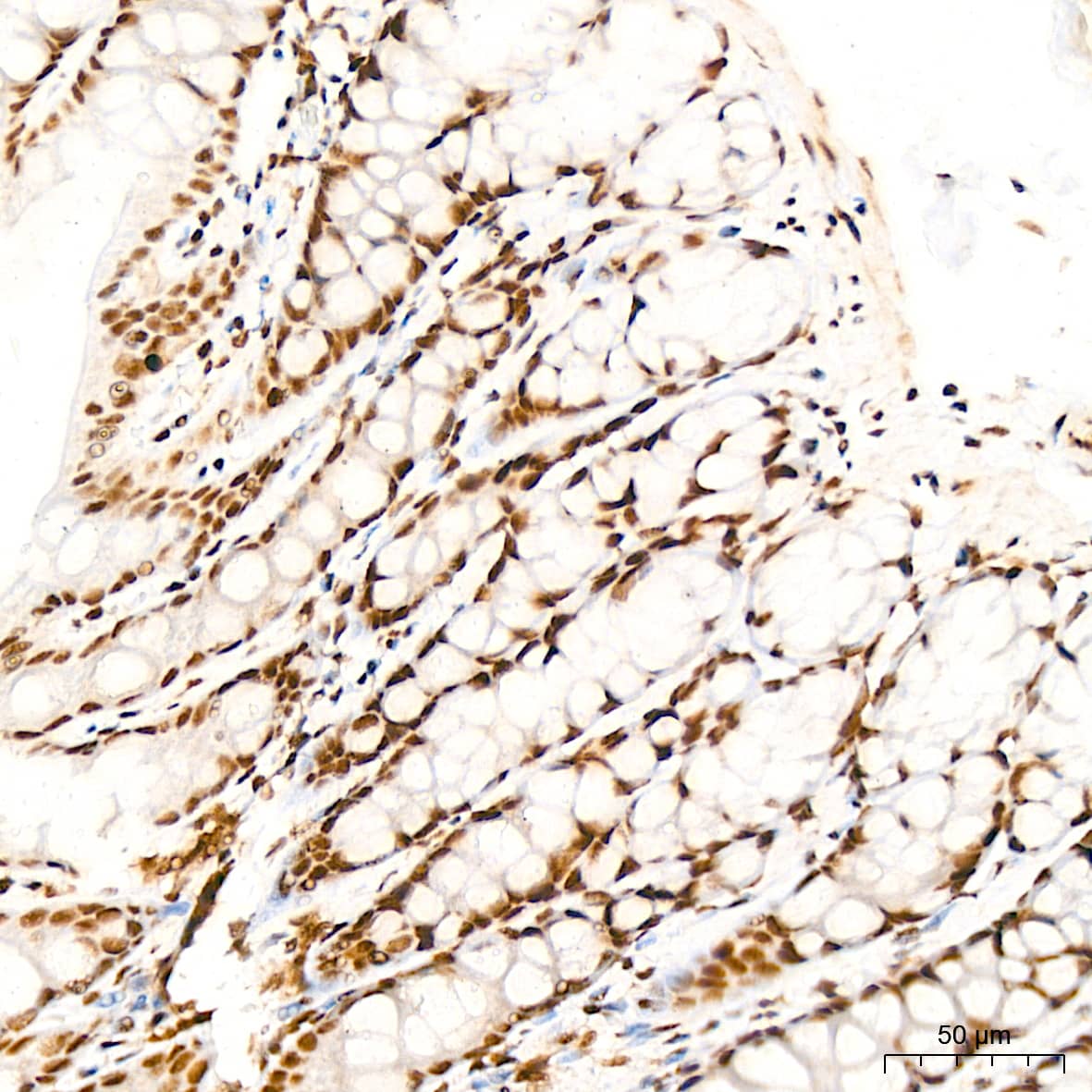 Immunohistochemistry: ILF3 Antibody (0S2N7) [NBP3-16664] - Immunohistochemistry analysis of ILF3 in paraffin-embedded rat colon tissue using ILF3 Rabbit mAb  at a dilution of 1:200 (40x lens). High pressure antigen retrieval was performed with 0.01 M citrate buffer (pH 6.0) prior to IHC staining.