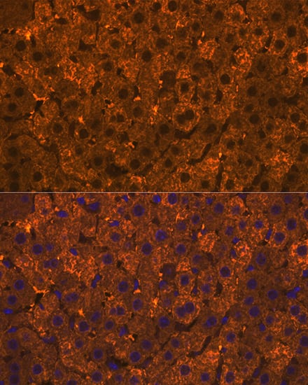 Immunocytochemistry/ Immunofluorescence: Cytosolic Sulfotransferase 2A1/SULT2A1 Antibody (4A3H6) [NBP3-16665] - Immunofluorescence analysis of rat liver using Cytosolic Sulfotransferase 2A1/SULT2A1 Rabbit mAb  at dilution of 1:100 (40x lens). Blue: DAPI for nuclear staining.