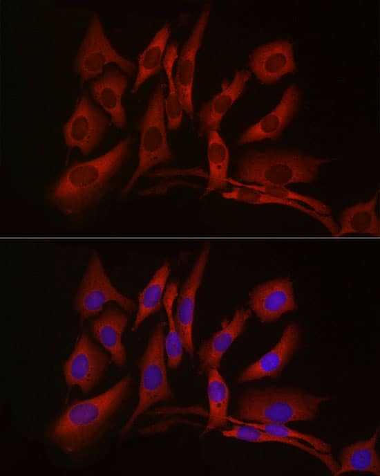 Immunocytochemistry/ Immunofluorescence: cGAS Antibody - BSA Free [NBP3-16666] - Immunofluorescence analysis of U2OS cells using cGAS Rabbit pAb at dilution of 1:50 (40x lens). Secondary antibody: Cy3-conjugated Goat anti-Rabbit IgG (H+L) at 1:500 dilution. Blue: DAPI for nuclear staining.