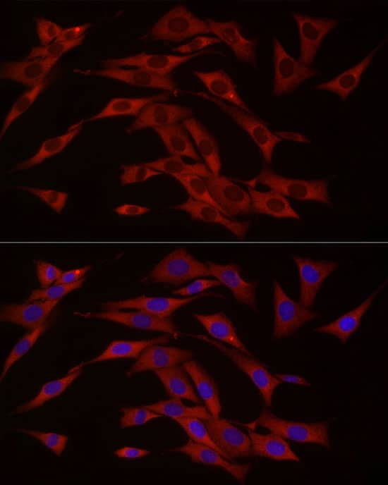 Immunocytochemistry/ Immunofluorescence: cGAS Antibody - BSA Free [NBP3-16666] - Immunofluorescence analysis of NIH/3T3 cells using cGAS Rabbit pAb at dilution of 1:50 (40x lens). Secondary antibody: Cy3-conjugated Goat anti-Rabbit IgG (H+L) at 1:500 dilution. Blue: DAPI for nuclear staining.
