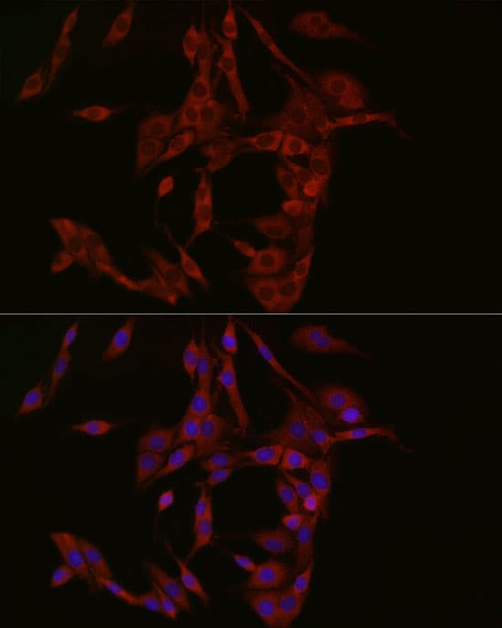 Immunocytochemistry/ Immunofluorescence: cGAS Antibody - BSA Free [NBP3-16666] - Immunofluorescence analysis of PC-12 cells using cGAS Rabbit pAb at dilution of 1:50 (40x lens). Secondary antibody: Cy3-conjugated Goat anti-Rabbit IgG (H+L) at 1:500 dilution. Blue: DAPI for nuclear staining.