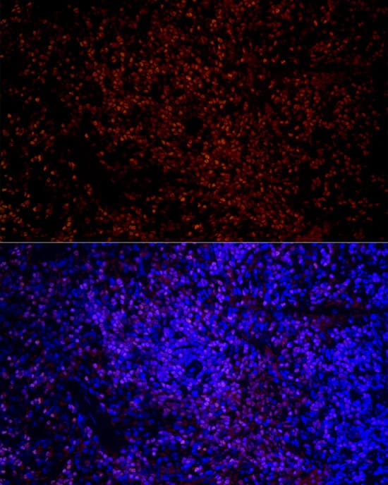 Immunocytochemistry/ Immunofluorescence: Aiolos/IKZF3 Antibody (4U7F9) [NBP3-16668] - Immunofluorescence analysis of paraffin-embedded rat spleen using Aiolos/IKZF3 Rabbit mAb at dilution of 1:100 (40x lens). Secondary antibody: Cy3-conjugated Goat anti-Rabbit IgG (H+L) at 1:500 dilution. Blue: DAPI for nuclear staining.