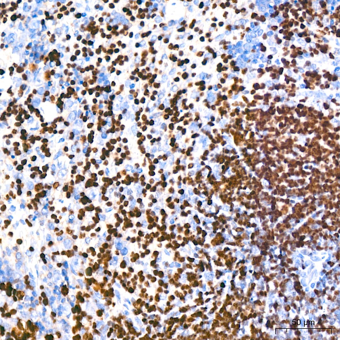 Immunohistochemistry: Aiolos/IKZF3 Antibody (4U7F9) [NBP3-16668] - Immunohistochemistry analysis of paraffin-embedded Mouse spleen tissue using Aiolos/IKZF3 Rabbit mAb at a dilution of 1:200 (40x lens). High pressure antigen retrieval performed with 0.01M Citrate Bufferr (pH 6.0) prior to IHC staining.