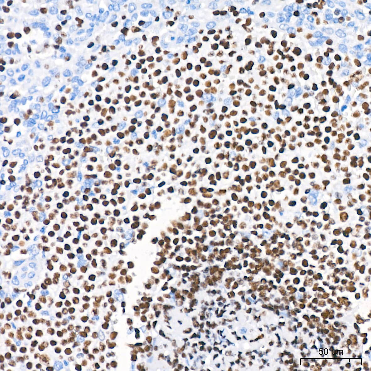 Immunohistochemistry: Aiolos/IKZF3 Antibody (4U7F9) [NBP3-16668] - Immunohistochemistry analysis of paraffin-embedded Human spleen tissue using Aiolos/IKZF3 Rabbit mAb at a dilution of 1:200 (40x lens). High pressure antigen retrieval performed with 0.01M Citrate Bufferr (pH 6.0) prior to IHC staining.