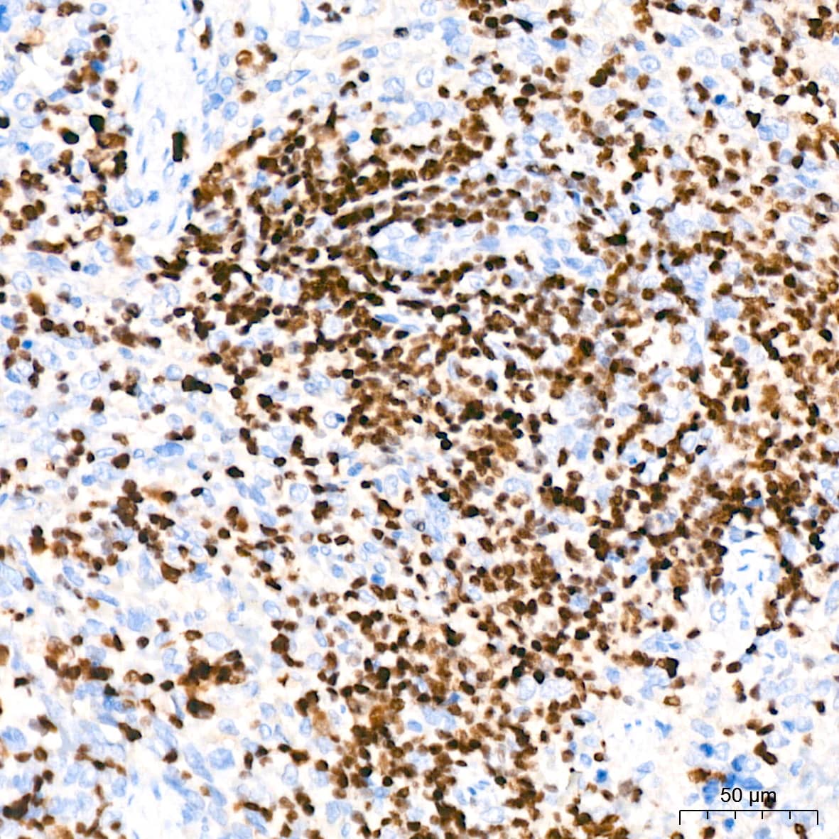 Immunohistochemistry: Aiolos/IKZF3 Antibody (4U7F9) [NBP3-16668] - Immunohistochemistry analysis of paraffin-embedded Rat spleen tissue using Aiolos/IKZF3 Rabbit mAb at a dilution of 1:200 (40x lens). High pressure antigen retrieval performed with 0.01M Citrate Bufferr (pH 6.0) prior to IHC staining.