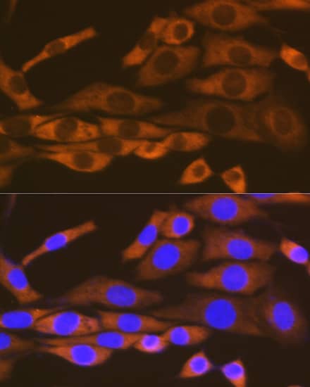 Immunocytochemistry/ Immunofluorescence: Lysyl tRNA synthetase Antibody (2V2B6) [NBP3-16670] - Immunofluorescence analysis of NIH-3T3 cells using Lysyl tRNA synthetase Rabbit mAb at dilution of 1:100 (40x lens). Secondary antibody: Cy3-conjugated Goat anti-Rabbit IgG (H+L) at 1:500 dilution. Blue: DAPI for nuclear staining.